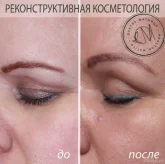 Клиника косметолога-эксперта Ольги Матийцо фото 6